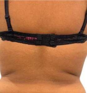 Before — Body tightening