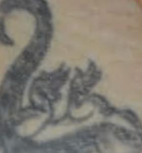 Before — Détatouage