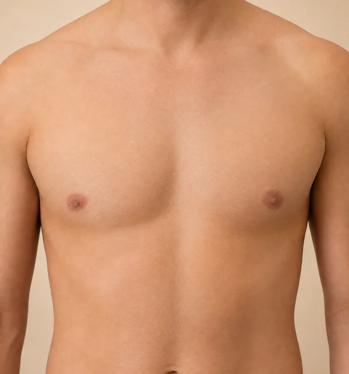 After — Hair removal