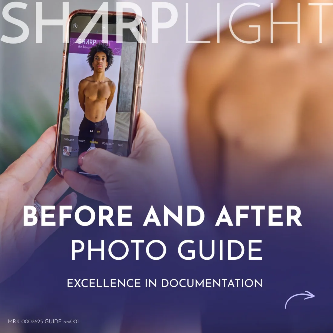 SharpLight Before and After Photo Guide cover