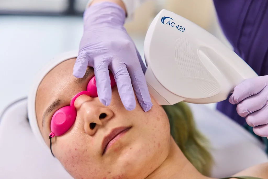 Practitioner treating active acne on a patient cheek with the AC 420 applicator
