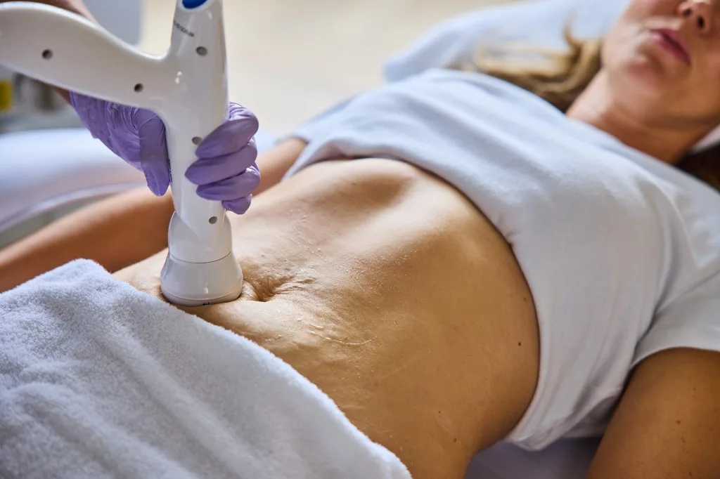 Close-up of RF body contouring applicator on a patient abdomen with conductive gel