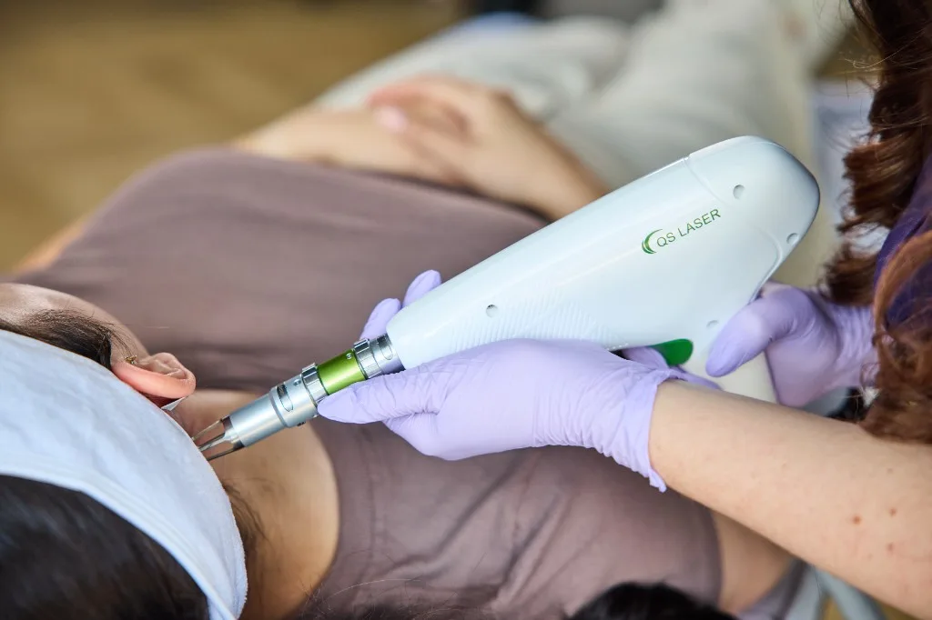 Tattoo Removal