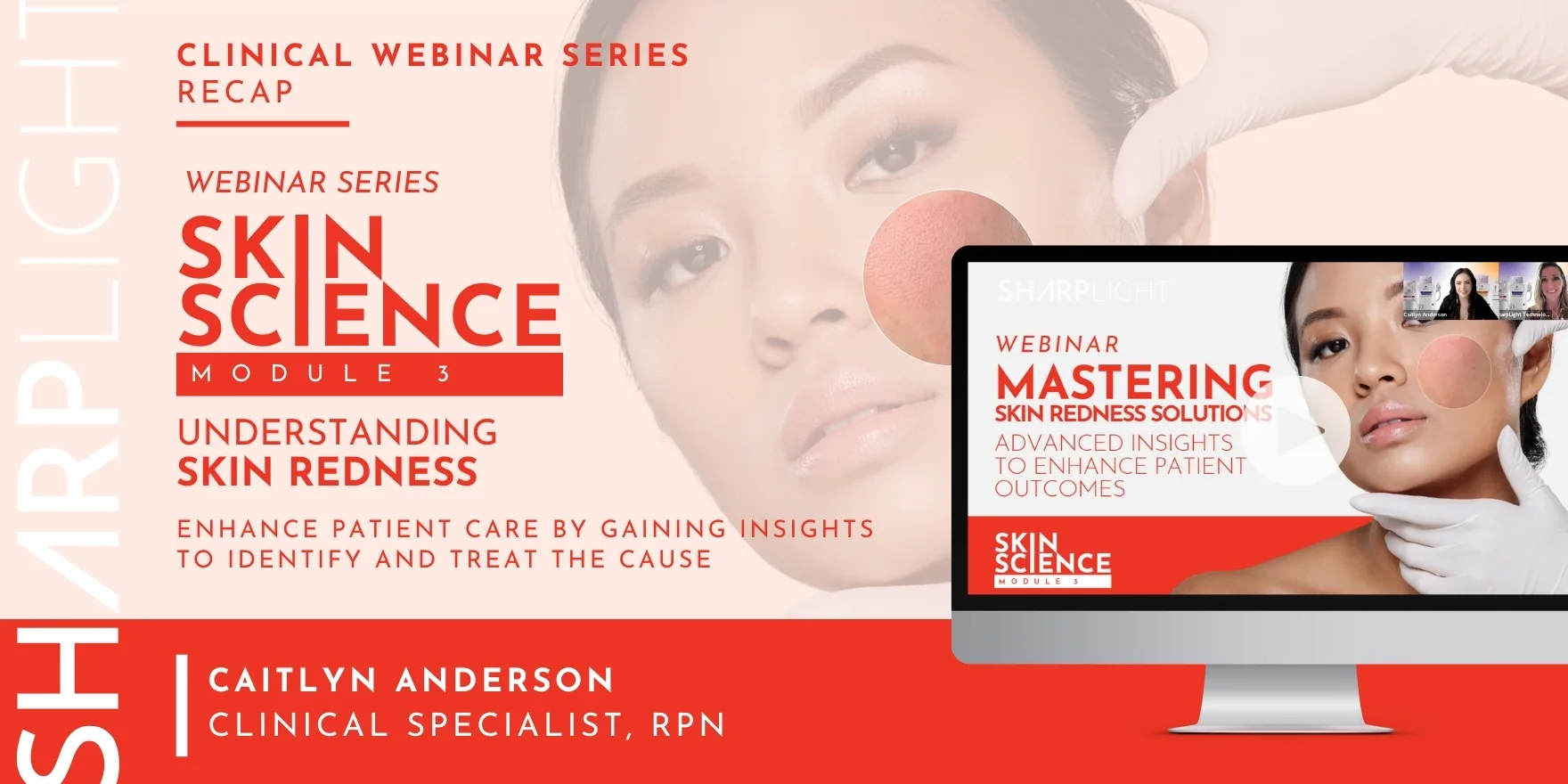 Skin Science: Understanding Skin Redness webinar thumbnail