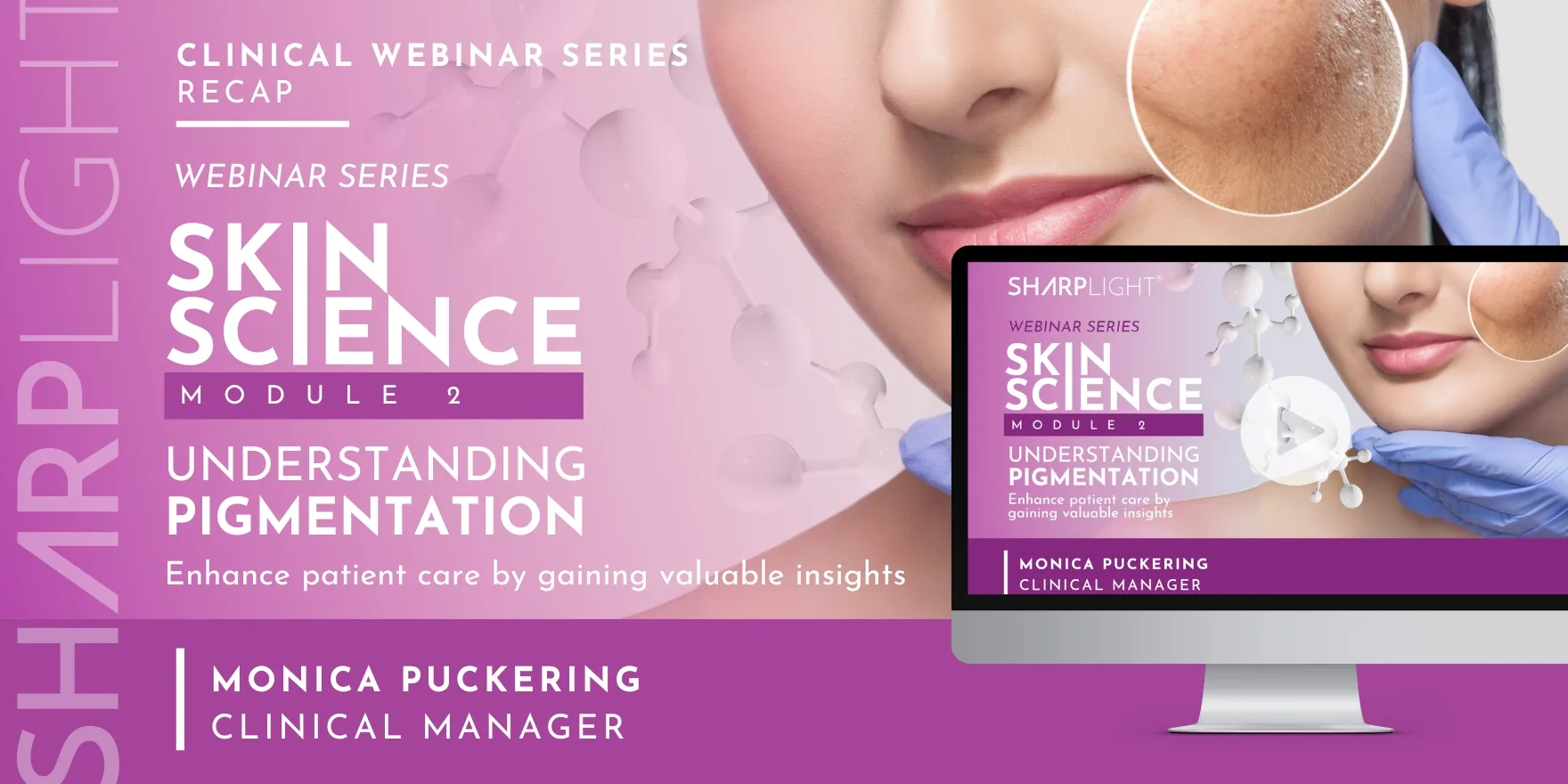 Skin Science: Understanding Pigmentation webinar thumbnail
