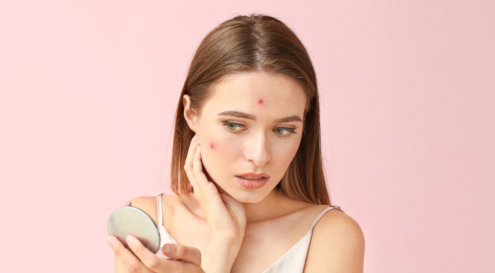 What Acne Treatments Actually Work?