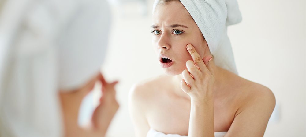 medical treatments for acne