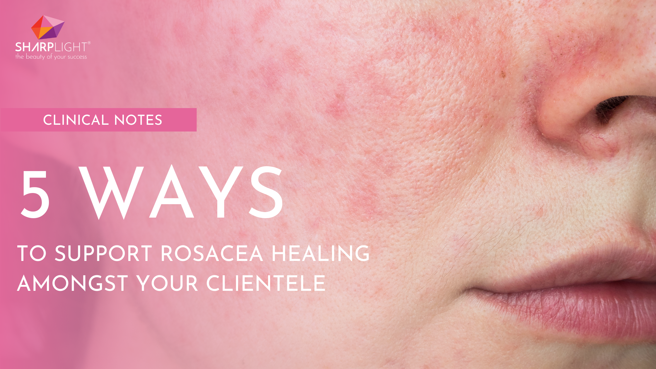 <h1>Clinical Notes: 5 Ways to Support Rosacea Healing Amongst Your Clientele </h1>