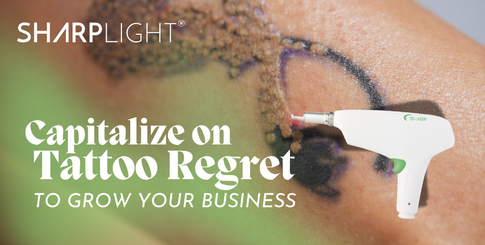 Laser Tattoo Removal: Capitalize on Tattoo Regret to Grow Your Business